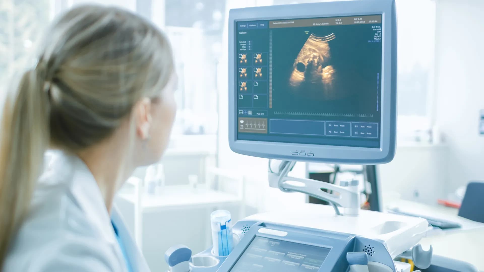 3D ultrasound scan in progress